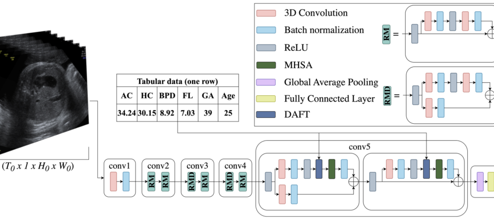 BabyNet_1