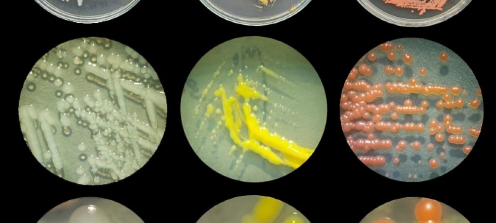 colony_morphology_Innonations
